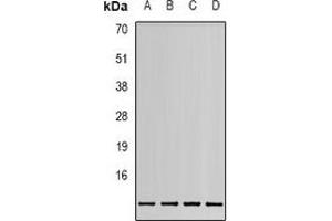 Western blot analysis of MIF expression in HEK293T (A), 22RV1 (B), Hela (C), HepG2 (D) whole cell lysates. (MIF 抗体)