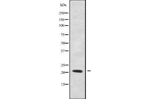 Western blot analysis of RHOXF1 using LOVO whole cell lysates (RHOXF1 抗体  (Internal Region))