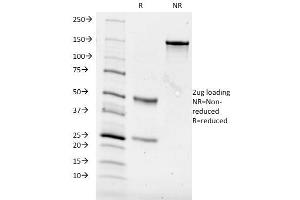 SDS-PAGE Analysis Purified CD84 Mouse Monoclonal Antibody (153-4D9). (CD84 抗体)