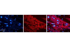Rabbit Anti-PCCA Antibody   Formalin Fixed Paraffin Embedded Tissue: Human heart Tissue Observed Staining: Cytoplasmic Primary Antibody Concentration: N/A Other Working Concentrations: 1:600 Secondary Antibody: Donkey anti-Rabbit-Cy3 Secondary Antibody Concentration: 1:200 Magnification: 20X Exposure Time: 0. (PCCA 抗体  (N-Term))