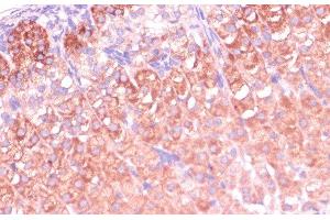 Immunohistochemistry of paraffin-embedded Mouse adrenal gland using CYP11B2 Polyclonal Antibody at dilution of 1:100 (40x lens). (CYP11B2 抗体)