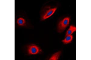 Immunofluorescent analysis of PTP1B staining in SKNSH cells. (PTPN1 抗体  (N-Term))