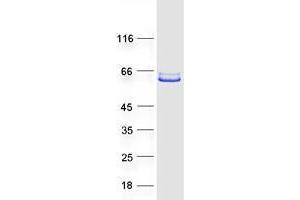 Western Blotting (WB) image for POC1 Centriolar Protein Homolog B (POC1B) protein (Myc-DYKDDDDK Tag) (ABIN2735521)