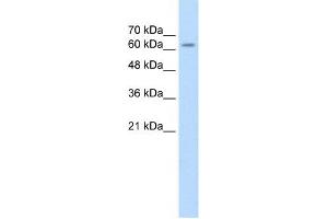 SARDH antibody used at 2. (SARDH 抗体  (Middle Region))