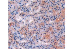 Used in DAB staining on fromalin fixed paraffin- embedded adrenal gland tissue (IL-17 抗体  (AA 18-150))