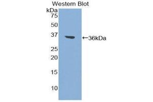 Western Blotting (WB) image for anti-Coagulation Factor II (thrombin) (F2) (AA 324-617) antibody (ABIN3207758) (Prothrombin 抗体  (AA 324-617))