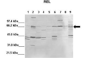 WB Suggested Anti-REL Antibody  Positive Control: Lane1: 100ug mouse liver, Lane2: 100ug mouse brain, Lane3: 100ug mouse heart, Lane4: 100ug mouse kidney, Lane5: 100ug mouse lung, Lane6: 100ug mouse thymus, Lane7: 100ug mouse spleen, Lane8: 100ug mouse testis, Lane9: 100ug mouse HeLa  Primary Antibody Dilution :  1:1000 Secondary Antibody :  Anti-rabbit-AP  Secondry Antibody Dilution :  1:10,000 Submitted by: Andreia Carvalho, Instituto de Biologia Molecular e Celular, Universidade do Porto (IBMC-UP) (c-Rel 抗体  (Middle Region))
