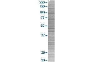 Western Blotting (WB) image for IL1RN 293T Cell Transient Overexpression Lysate(Denatured) (ABIN1332326)
