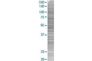 IL1RN transfected lysate. (IL1RN 293T Cell Transient Overexpression Lysate(Denatured))