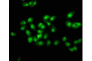 Immunofluorescence staining of ntera-2 cells with ABIN7172619 at 1:100, counter-stained with DAPI. (SOX21 抗体  (AA 25-126))