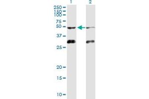 Western Blotting (WB) image for anti-Activin A Receptor, Type IB (ACVR1B) (AA 1-505) antibody (ABIN513100)
