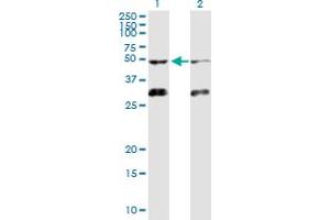 Western Blot analysis of ACVR1B expression in transfected 293T cell line by ACVR1B MaxPab polyclonal antibody. (Activin A Receptor Type IB/ALK-4 抗体  (AA 1-505))