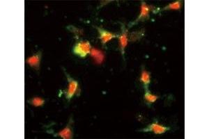 Immunofluorescence analysis of CCL2 antibody with HeLa cells.