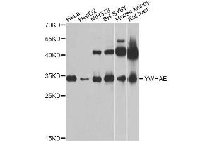 Western blot analysis of extracts of various cell lines, using YWHAE Antibody (ABIN5970417) at 1/1000 dilution. (YWHAE 抗体)