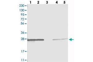 Western blot analysis of Lane 1: RT-4, Lane 2: U-251 MG, Lane 3: Human Plasma, Lane 4: Liver, Lane 5: Tonsil with PMM1 polyclonal antibody . (PMM1 抗体)