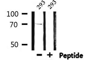 Western blot analysis of extracts from 293, using S6K Antibody. (RPS6KB1 抗体  (C-Term))