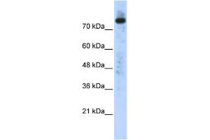 WB Suggested Anti-PLD2 Antibody Titration:  0. (Phospholipase D2 抗体  (N-Term))