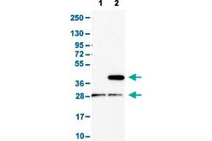 Western Blot analysis with CD1E polyclonal antibody . (CD1e 抗体  (AA 79-147))