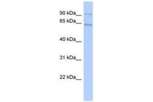 ZNF319 anticorps  (AA 35-84)