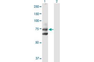 Western Blot analysis of HHIP expression in transfected 293T cell line by HHIP MaxPab polyclonal antibody. (HHIP 抗体  (AA 1-700))