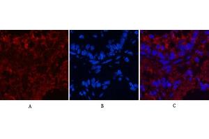 anti-CD4 (CD4) antibody