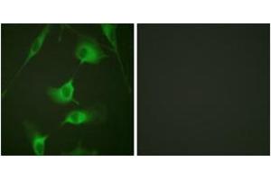 Immunofluorescence analysis of HeLa cells, using Keratin 8 (Ab-431) Antibody. (KRT8 抗体  (AA 401-450))