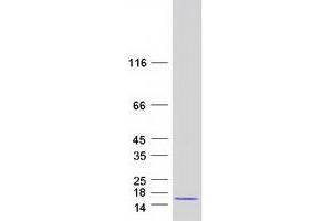 Western Blotting (WB) image for Cyclin-dependent kinases regulatory subunit 2 (CKS2) protein (Myc-DYKDDDDK Tag) (ABIN2712844)