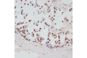 Immunohistochemistry (IHC) image for anti-Ribosomal Protein S6 Kinase, 90kDa, Polypeptide 5 (RPS6KA5) (pSer376) antibody (ABIN7270039)
