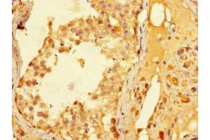 Immunohistochemistry of paraffin-embedded human testis tissue using ABIN7176667 at dilution of 1:100 (ELAC1 抗体  (AA 1-363))