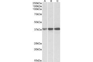 ABIN768561 (0. (IDH3A 抗体  (C-Term))