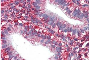 Human Uterus (formalin-fixed, paraffin-embedded) stained with VIM antibody ABIN364428 at 10 ug/ml followed by biotinylated anti-mouse IgG secondary antibody ABIN481714, alkaline phosphatase-streptavidin and chromogen.