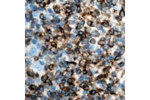 Immunohistochemical analysis of IFN gamma staining in human lymph node formalin fixed paraffin embedded tissue section. (Interferon gamma 抗体  (Center))