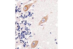 Immunohistochemical analysis of paraffin-embedded H. (PAPD4 抗体  (N-Term))