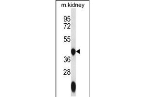 Western blot analysis in mouse kidney tissue lysates (35ug/lane). (GTPBP10 抗体  (C-Term))