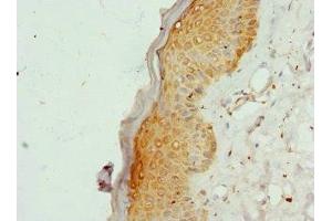 Immunohistochemistry of paraffin-embedded human skin tissue using ABIN7148255 at dilution of 1:100 (COL9A3 抗体  (AA 445-684))