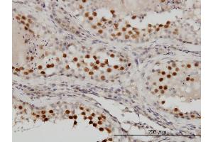 Immunoperoxidase of monoclonal antibody to RACGAP1 on formalin-fixed paraffin-embedded human testis. (RACGAP1 抗体  (AA 1-110))