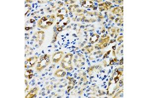 Immunohistochemistry (Paraffin-embedded Sections) (IHC (p)) image for anti-Ribophorin 1 (RPN1) (AA 20-280) antibody (ABIN6147170)