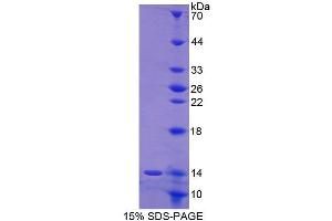 SDS-PAGE (SDS) image for Keratin 1 (KRT1) (AA 489-625) protein (His tag) (ABIN1980750)