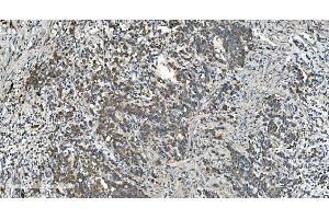 IHC analysis of NOX2/gp91phox/CYBB using anti-NOX2/gp91phox/CYBB antibody (ABIN7599875). (CYBB 抗体  (AA 124-559))