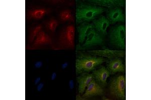 ABIN6265260 and ABIN6276508 staining  cells by IF/ICC.