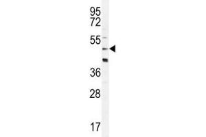 CRFR2D antibody western blot analysis in HeLa lysate (CRFR2D 抗体)