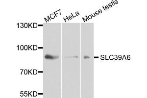 Western blot analysis of extracts of various cell lines, using SLC39A6 antibody. (SLC39A6 抗体)