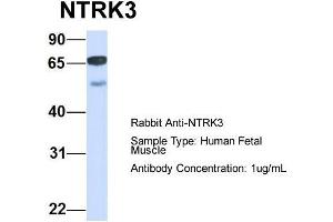 Host:  Rabbit  Target Name:  NTRK3  Sample Type:  Human Fetal Muscle  Antibody Dilution:  1. (NTRK3 抗体  (C-Term))