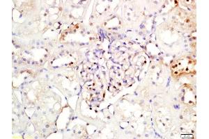 Immunohistochemistry (Paraffin-embedded Sections) (IHC (p)) image for anti-Nuclear Factor of kappa Light Polypeptide Gene Enhancer in B-Cells Inhibitor, alpha (NFKBIA) (AA 1-120) antibody (ABIN674454)