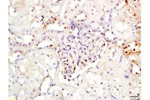 Formalin-fixed and paraffin embedded rat kidney labeled with Rabbit Anti-NFKBIA/IKB alpha Polyclonal Antibody, Unconjugated (ABIN674454) at 1:200 followed by conjugation to the secondary antibody and DAB staining (NFKBIA 抗体  (AA 1-120))