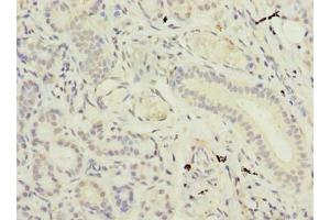 Immunohistochemistry of paraffin-embedded human pancreatic tissue using ABIN7171032 at dilution of 1:100 (SUSD4 抗体  (AA 56-290))