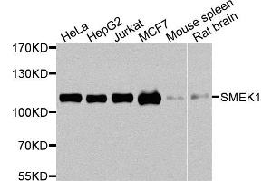 Western blot analysis of extracts of various cells, using SMEK1 antibody. (SMEK1 抗体)