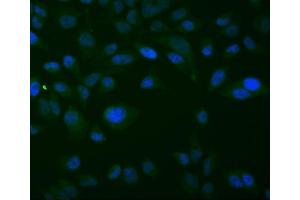 IF analysis of Thioredoxin 2/TXN2 using anti-Thioredoxin 2/TXN2 antibody (ABIN7602148).