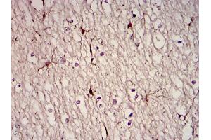 Immunohistochemical analysis of paraffin-embedded brain tissues using GFAP mouse mAb with DAB staining (GFAP 抗体)