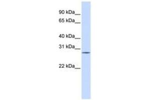 Image no. 1 for anti-Spleen Focus Forming Virus (SFFV) Proviral Integration Oncogene Spi1 (SPI1) (C-Term) antibody (ABIN6740536)